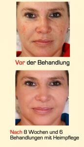 Begeisterte Kundinnen von Kosmetik Lee dank Gesichtsbehandlung