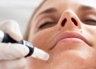 Modernes Microneedling mit dem DermaPen