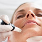 Modernes Microneedling mit dem DermaPen
