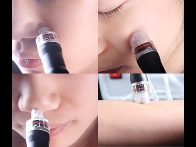 Aqua Peel, Aquapeeling, Hydrodermabrasion bei Kosemtik Lee