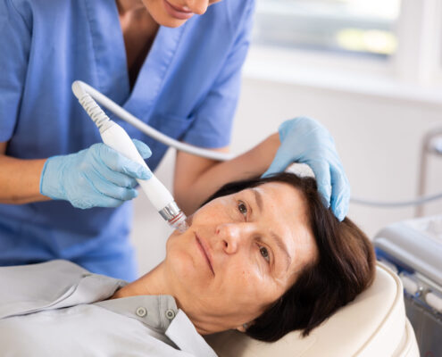 Perfektes Anti Aging RF-Microneedling kombiniert feine Mikronadeln mit gezielter Radiofrequenzenergie. Während die Nadeln kontrollierte Mikrokanäle in der Haut erzeugen, wird gleichzeitig Wärme in tiefere Hautschichten abgegeben.