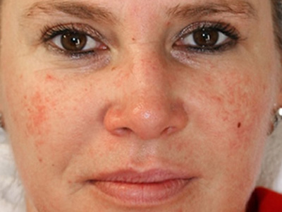 begeisterte kundinnen von kosmetik lee dank gesichtsbehandlung kosmetik studio basel