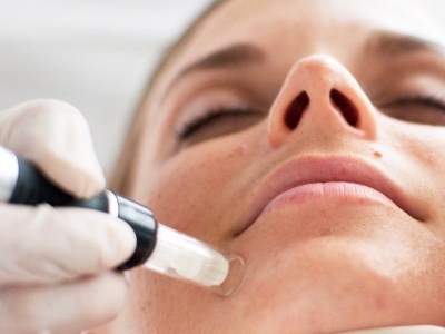 400-300-LEE-Microneedling_Behandlung-Kosmetik-Studio-Basel