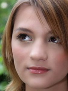 lee-akne-after-kosmetik-studio-basel