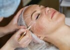 HIFI Behandlung bei Kosmetik Lee