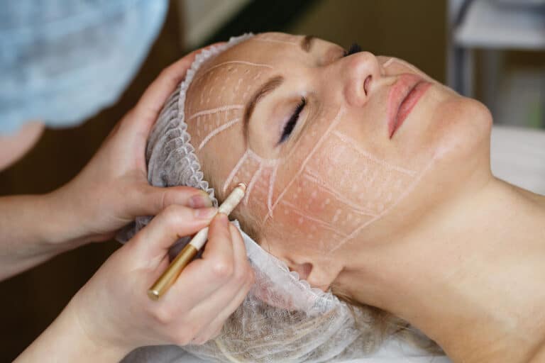 HIFI Behandlung bei Kosmetik Lee