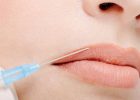 hyaluron and botox kosmetik studio basel