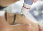 hydrodermabrasion kosmetik studio basel