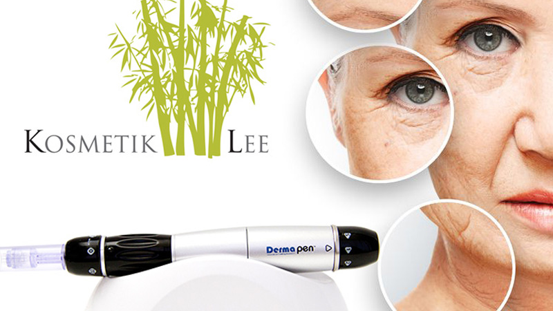 micro needling for beauty kosmetik studio basel