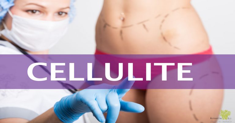 Mit hochintensivem Ultraschall gegen Cellulite