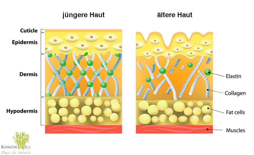 Anti Aging mittels Mesoporationstherapie