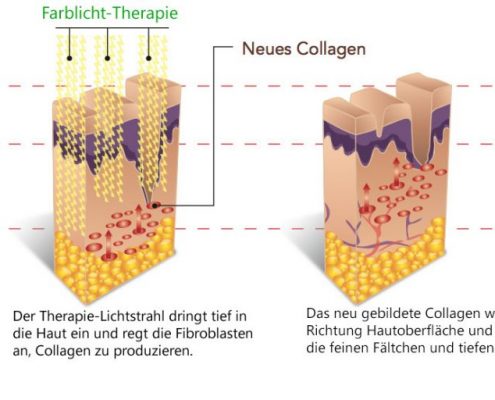 Farblicht_Anti_aging