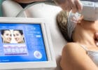HIFU Lifting gegen Falten