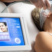 HIFU Lifting gegen Falten