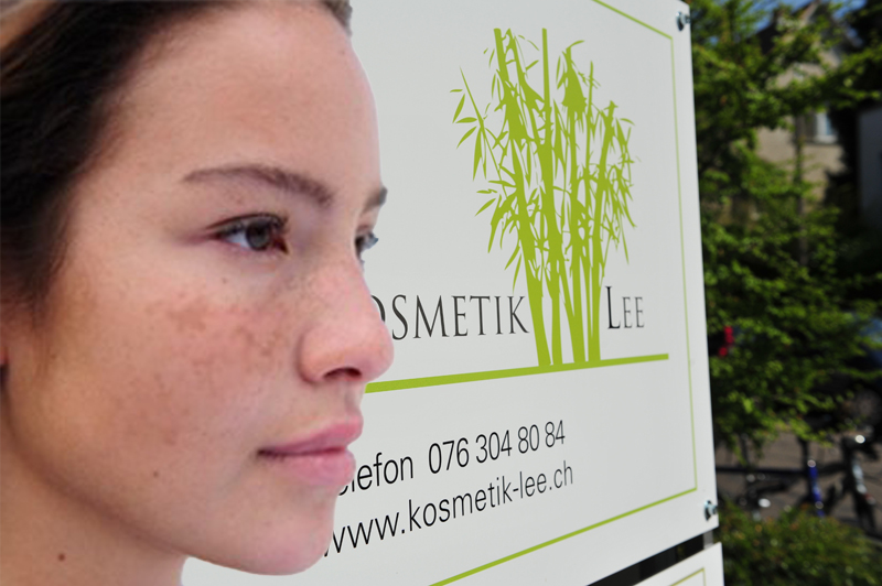 Pigmentflecke, Hyperpigmentation