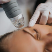 Radiofrequenz Microneedling