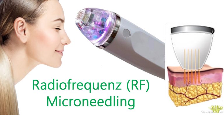 Microneedling Radiofrequenz