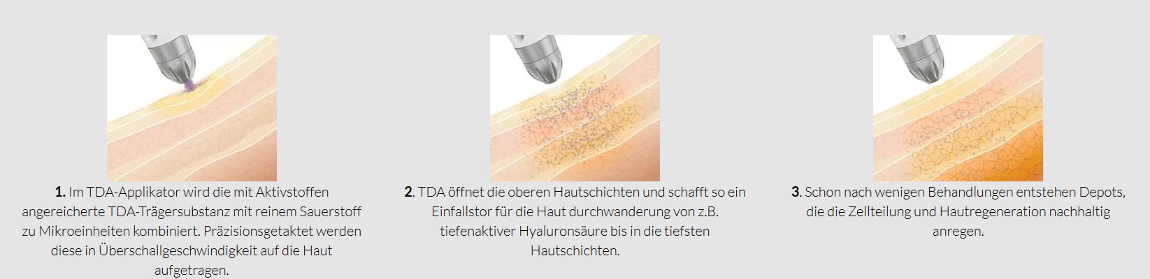 TDA Methode Erklärt TDA Sauerstoffbehandlung
