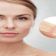 TDA Sauerstoffbehandlung Kosmetik Lee