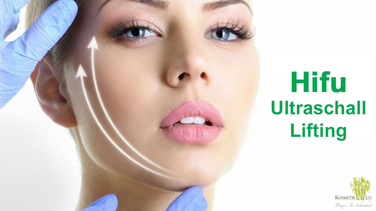 HIFU Hautstraffung und Lifting mit Ultraschall